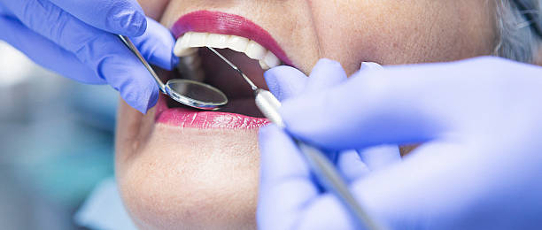 Best Emergency Broken Tooth Repair in Spring Mount, PA